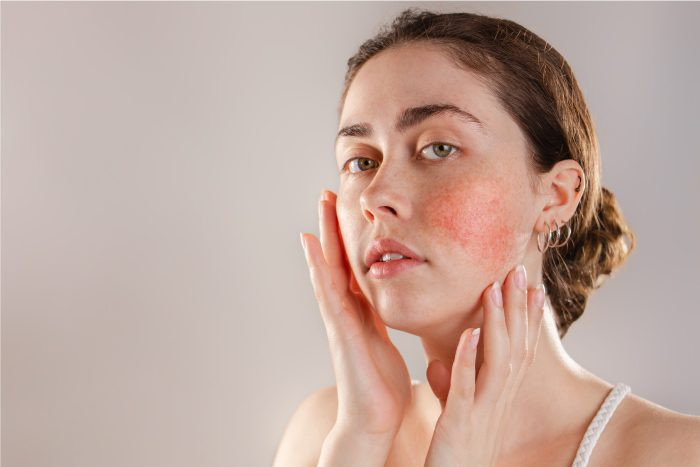 Silica for Redness: Supportive Skin-Barrier Language, Not Medical Claims